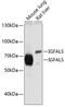 Insulin Like Growth Factor Binding Protein Acid Labile Subunit antibody, 13-515, ProSci, Western Blot image 