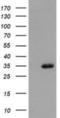 Sulfotransferase 1A1 antibody, NBP2-03227, Novus Biologicals, Western Blot image 