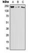 Dedicator Of Cytokinesis 11 antibody, MBS820518, MyBioSource, Western Blot image 