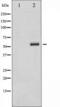 Serine/threonine-protein kinase Chk1 antibody, TA325367, Origene, Western Blot image 