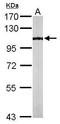 Lysine Acetyltransferase 2B antibody, TA308325, Origene, Western Blot image 
