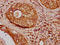 Histone Cluster 1 H1 Family Member E antibody, LS-C676865, Lifespan Biosciences, Immunohistochemistry paraffin image 