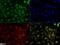 NUT Midline Carcinoma Family Member 1 antibody, NBP2-31370, Novus Biologicals, Immunofluorescence image 