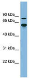 ATP Binding Cassette Subfamily F Member 2 antibody, TA332055, Origene, Western Blot image 