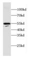 Carboxypeptidase E antibody, FNab01266, FineTest, Western Blot image 