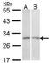 NCA antibody, PA5-29551, Invitrogen Antibodies, Western Blot image 