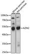 Arginine decarboxylase antibody, 16-333, ProSci, Western Blot image 