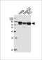Protein Kinase AMP-Activated Non-Catalytic Subunit Gamma 3 antibody, 58-783, ProSci, Western Blot image 