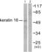 Keratin 16 antibody, abx013120, Abbexa, Western Blot image 