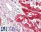 L-xylulose reductase antibody, LS-B9182, Lifespan Biosciences, Immunohistochemistry paraffin image 
