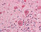 pp60c-src antibody, ADI-KAS-TK121-C, Enzo Life Sciences, Immunohistochemistry paraffin image 