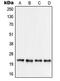 Ribosomal Protein S9 antibody, MBS821807, MyBioSource, Western Blot image 
