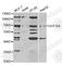 UDP Glucuronosyltransferase Family 1 Member A4 antibody, A5549, ABclonal Technology, Western Blot image 
