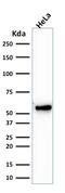 Keratin 7 antibody, GTX34660, GeneTex, Western Blot image 