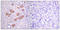 Neutrophil cytosol factor 4 antibody, LS-C199374, Lifespan Biosciences, Immunohistochemistry paraffin image 