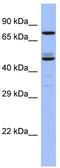 TBC1 Domain Family Member 25 antibody, TA337672, Origene, Western Blot image 