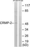 Dihydropyrimidinase Like 2 antibody, TA313763, Origene, Western Blot image 