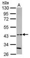 Hyaluronan And Proteoglycan Link Protein 3 antibody, GTX117720, GeneTex, Western Blot image 
