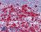 Deoxyuridine Triphosphatase antibody, LS-B4315, Lifespan Biosciences, Immunohistochemistry paraffin image 