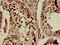 DEAD-Box Helicase 4 antibody, LS-C677659, Lifespan Biosciences, Immunohistochemistry paraffin image 