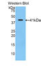 Angiotensinogen antibody, LS-C292839, Lifespan Biosciences, Western Blot image 