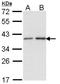 AAC2 antibody, NBP1-33751, Novus Biologicals, Western Blot image 
