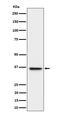 UL16 Binding Protein 1 antibody, M04323, Boster Biological Technology, Western Blot image 