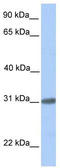 Chromosome 7 Open Reading Frame 61 antibody, TA336186, Origene, Western Blot image 