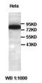 Actin Binding LIM Protein 1 antibody, orb77655, Biorbyt, Western Blot image 