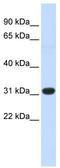 Homeobox protein Hox-C8 antibody, TA345364, Origene, Western Blot image 