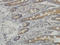 Mitogen-Activated Protein Kinase Kinase Kinase 4 antibody, LS-C133320, Lifespan Biosciences, Immunohistochemistry paraffin image 