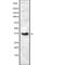 Carcinoembryonic Antigen Related Cell Adhesion Molecule 6 antibody, abx149190, Abbexa, Western Blot image 