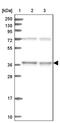 Chromosome 11 Open Reading Frame 54 antibody, PA5-59062, Invitrogen Antibodies, Western Blot image 
