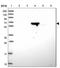 Zinc Finger Protein 304 antibody, NBP2-31901, Novus Biologicals, Western Blot image 