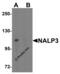 NLR Family Pyrin Domain Containing 3 antibody, 5447, ProSci, Western Blot image 
