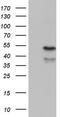 Ectonucleoside Triphosphate Diphosphohydrolase 1 antibody, TA804587, Origene, Western Blot image 