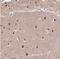ST18 C2H2C-Type Zinc Finger Transcription Factor antibody, NBP1-92445, Novus Biologicals, Immunohistochemistry paraffin image 