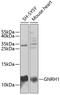 Gonadotropin Releasing Hormone 1 antibody, 19-763, ProSci, Western Blot image 