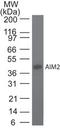Absent In Melanoma 2 antibody, TA337163, Origene, Western Blot image 