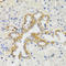 SH2B Adaptor Protein 1 antibody, STJ27510, St John