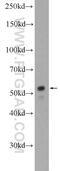 DNA repair protein XRCC4 antibody, 15817-1-AP, Proteintech Group, Western Blot image 