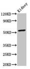 Cytochrome P450 2C19 antibody, CSB-PA006417LA01HU, Cusabio, Western Blot image 