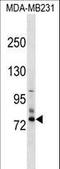 ENaCD antibody, LS-C158926, Lifespan Biosciences, Western Blot image 