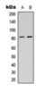 Ubiquitin Specific Peptidase 44 antibody, orb393184, Biorbyt, Western Blot image 