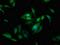 SSX Family Member 2 Interacting Protein antibody, orb416237, Biorbyt, Immunocytochemistry image 