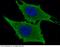Leukotriene A4 Hydrolase antibody, 10276-R201, Sino Biological, Immunohistochemistry paraffin image 