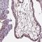 Amphiregulin antibody, HPA008720, Atlas Antibodies, Immunohistochemistry paraffin image 