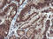 Von Hippel-Lindau disease tumor suppressor antibody, LS-C174737, Lifespan Biosciences, Immunohistochemistry frozen image 