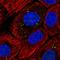 Filaggrin antibody, HPA030188, Atlas Antibodies, Immunofluorescence image 