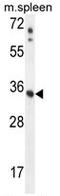 Ankyrin Repeat And SOCS Box Containing 17 antibody, AP50268PU-N, Origene, Western Blot image 